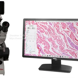 4K/1080P Adaptive Camera Industrial Camera Electron Microscope thumbnail-4
