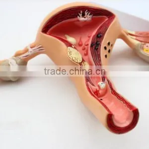Human Uterus and Ovary Vaginal Pathological Changes Model of Reproductive Department of Gynecology Medical Demonstration Model thumbnail-3