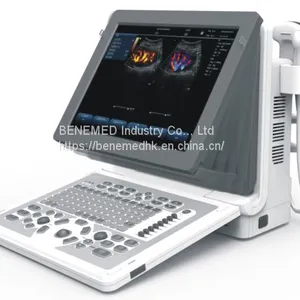 2D Echo Color Doppler Ultrasound Scanner thumbnail-1