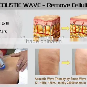 Shock Waves Machine Shockwaves SHOCK WAVE MACHINE thumbnail-2