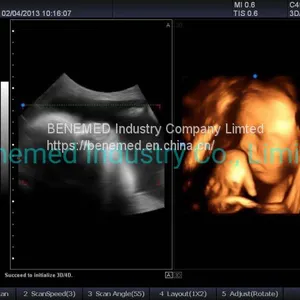 Premium 4D Color Doppler Ultrasound Scanner thumbnail-4