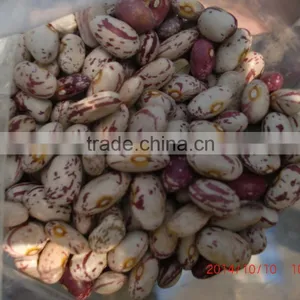 Light Speckled Kidney Bean on Sale thumbnail-3