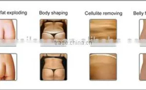New Products Looking for Distributor! 650nm Lipo Diode Laser Slimming Machine thumbnail-6