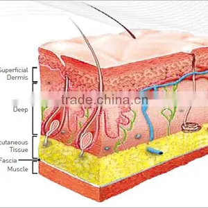 Hifu Focused Ultrasound Transducer Skin Lifting thumbnail-5