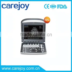 Promotion!!CE Approved Portable Chison USB Ultrasound Scanner With 3.5Mhz Multi-frequency Convex Probe ECO1 thumbnail-1