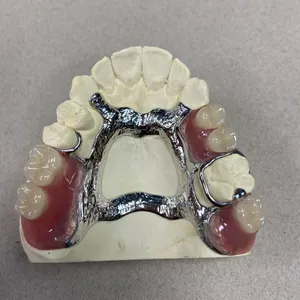 Full Metal Crown and Bridge thumbnail-4