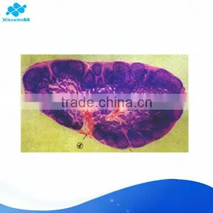 Lymph Node Microscope Slide thumbnail-1
