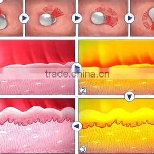 Forehead Wrinkle Removal Factory Price 10000 Times Hifu Vaginal Tightening Machine/vaginal Rejuvenation High Focused Ultrasonic thumbnail-6