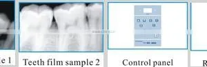 Dental X-Ray Unit (standing Type) thumbnail-3