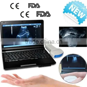 CE FDA Mark 10 Inch Laptop Veterinary / Vet Ultrasound Scanner With 3.5MHz Convex Probe Rectal With USB Port thumbnail-1