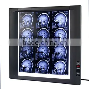 High Brightness LED X Ray Film Viewer thumbnail-1