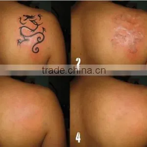 Q Switched Nd Yag Laser With Anti-puffiness 1500mj System And Skin Whitening Machine Beauty Eauipment 1-10Hz thumbnail-6