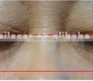 Pigment Removal Hot Promotion!!! HIFU Body Slimming 0.2-3.0J Body Slim Equipment & Machine thumbnail-6