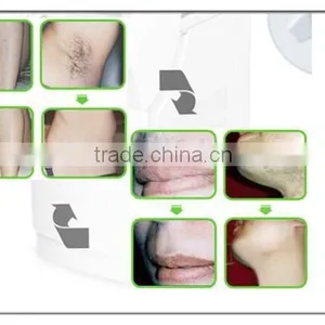 Oem Medical Luxurious Design Portable 808nm Machine Diode Laser Hair Removal Permanent thumbnail-6