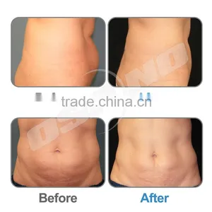 Body Reshaping Machine Aesthetic Vacuum RF Massage Cavittaion Therapy Body Rejuvenation thumbnail-6