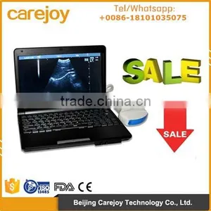 Low Price Full Digital Laptop Ultrasound Scanner RUS-9000F With 3.5Mhz Convex Probe Suitale for Carrying Easy thumbnail-1