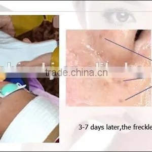 Best Facial Removal Salom Beauty Machine With Beauty Energy Bar thumbnail-5