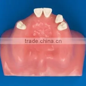 Factory Price Clinical Drill Model Cableway/ Dental Implant Model/implantes for Teeth thumbnail-2