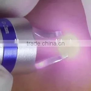 980nm Spider Vein Removal China 15w Diode Laser Price for Beauty Clinic thumbnail-3