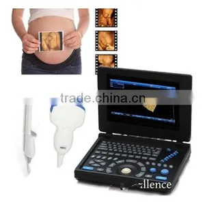 Laptop Ultrasound Scanner With Multi-frequency Probe Ultrasonography 10 Inch Good Design thumbnail-1