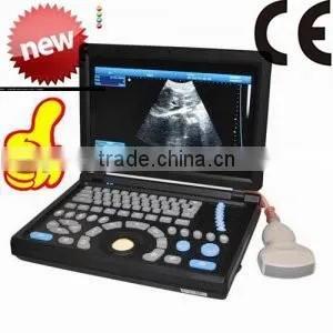Notebook/Laptop RUS-9000E2 Portable Ultrasound Scanner/machine With Convex Probe, Linear, Vaginal, Rectal Probe-Shelly thumbnail-1
