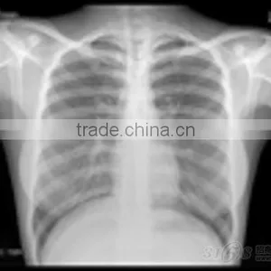 Konida x Ray Film for Radiography Examination With CE thumbnail-1