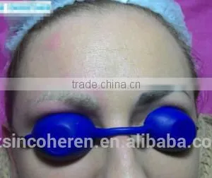 nd Yag Laser Tatoo Removal Machine Carbon Peeling Treatment for Skin Rejuvenation thumbnail-5