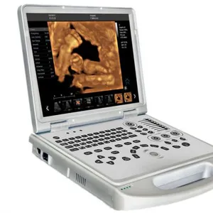Portable Color Doppler Ultrasound With CE thumbnail-2