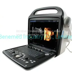Premium 4D Color Doppler Ultrasound Scanner thumbnail-2