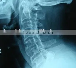 Dry Film X-ray Film Blue Medical Film China Film thumbnail-1