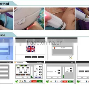 Permanent Ipl Hair Removal thumbnail-5
