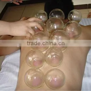 Raditional Fire Cupping, Glass Cupping thumbnail-1