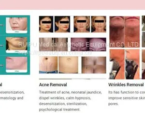 Personal Care PDT LED Skin Rejuvenation Device thumbnail-5