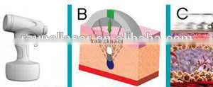 2016 Trending Cellulite Removal Liposuction Cavitation For Sale thumbnail-2