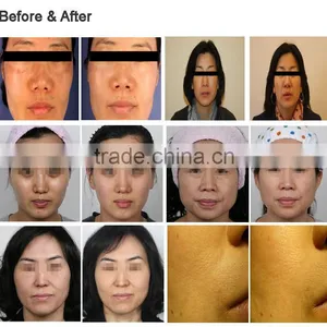 DQ-88 Multi-needles and Single Needle Mesotherapy thumbnail-6