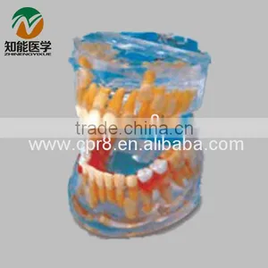 Transparent Baby Teeth Development Model BIX - L1009 thumbnail-1