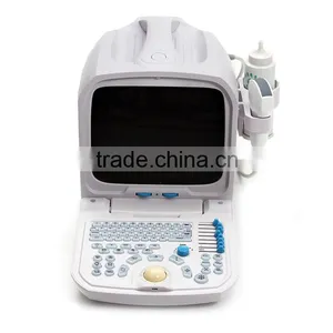 China Portable Medical Gynecology 10 Inch Ultrasound Machine / Equipment Price thumbnail-2