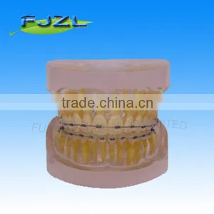 Orthodontic Teeth Model(Transparent Model , Normal Tooth, Invisible Brackets),dental Orthodontic Models thumbnail-1