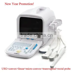 Promotion!!CE Approved Portable Ultrasound Scanner With 3.5Mhz Multi-frequency Convex Probe RUS-9000A thumbnail-1