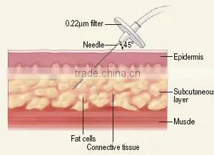Hottest ,Newest Co2 Carboxytherapy Machine for Face Wrinkle Remover thumbnail-5