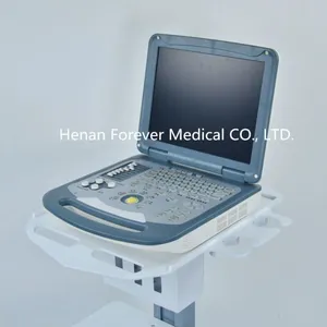 Portable Ultrasound Color Doppler Gynaecology Ultrasound thumbnail-4
