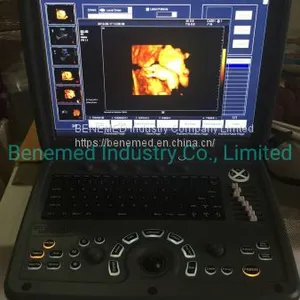Premium 4D Color Doppler Ultrasound Scanner thumbnail-3