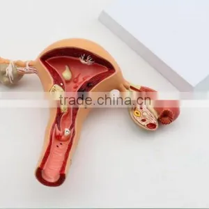 Human Uterus and Ovary Vaginal Pathological Changes Model of Reproductive Department of Gynecology Medical Demonstration Model thumbnail-5
