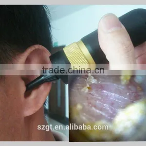 Ear Inspection Camera USB/ear Video Camera/medical Endoscope Camera/medical Endoscope Usb Camera thumbnail-2