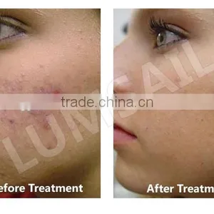 CE Approval PDT LED Phototherapy Skin Lightening Beauty Personal Care Beauty System thumbnail-3