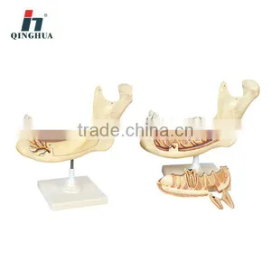 Human Teeth thumbnail-1