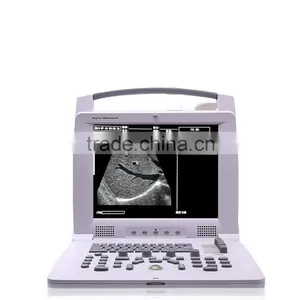 OB/GYN CE FDA Compact Multi-purpose Portable Doppler Ultrasound Scan thumbnail-5