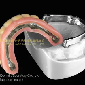 Dental Implant Bar, Implant Overdenture, Implant Prosthesis, Laboratoire Dentaire, Dentallabor, Laboratorio Dental, Dental Laboratory, Shenzhen LJ Dental Lab China thumbnail-4