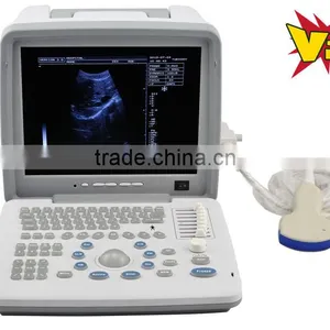 Ultrasound Machine Scanner With Convex Probe Transvaginal Micro-convex Rectal Probe With CE ISO Approved thumbnail-1