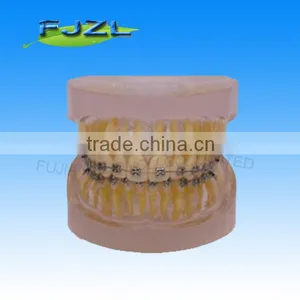 Orthodontic Teeth Model(Transparent Model , Normal Tooth, Common Brackets)/dental Orthodontic Models thumbnail-1